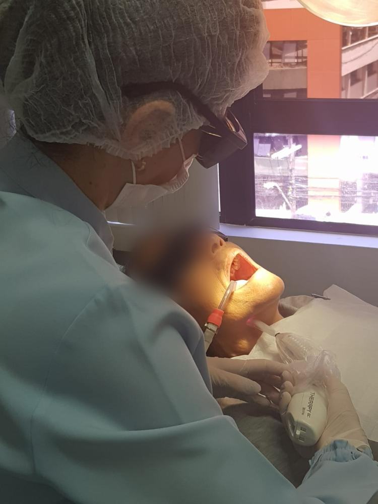 Laserterapia no estímulo às glândulas salivares